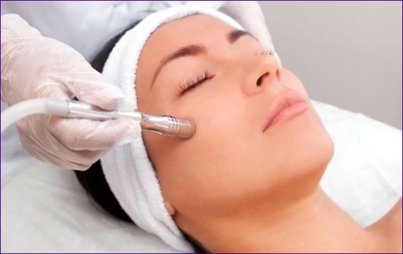 Mekanisk dermabrasion