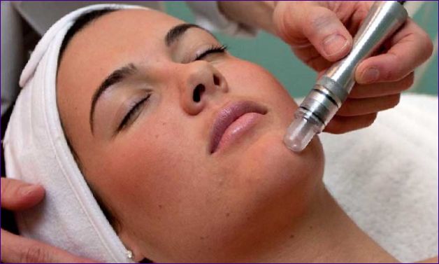 mikrokrystallinsk dermabrasion